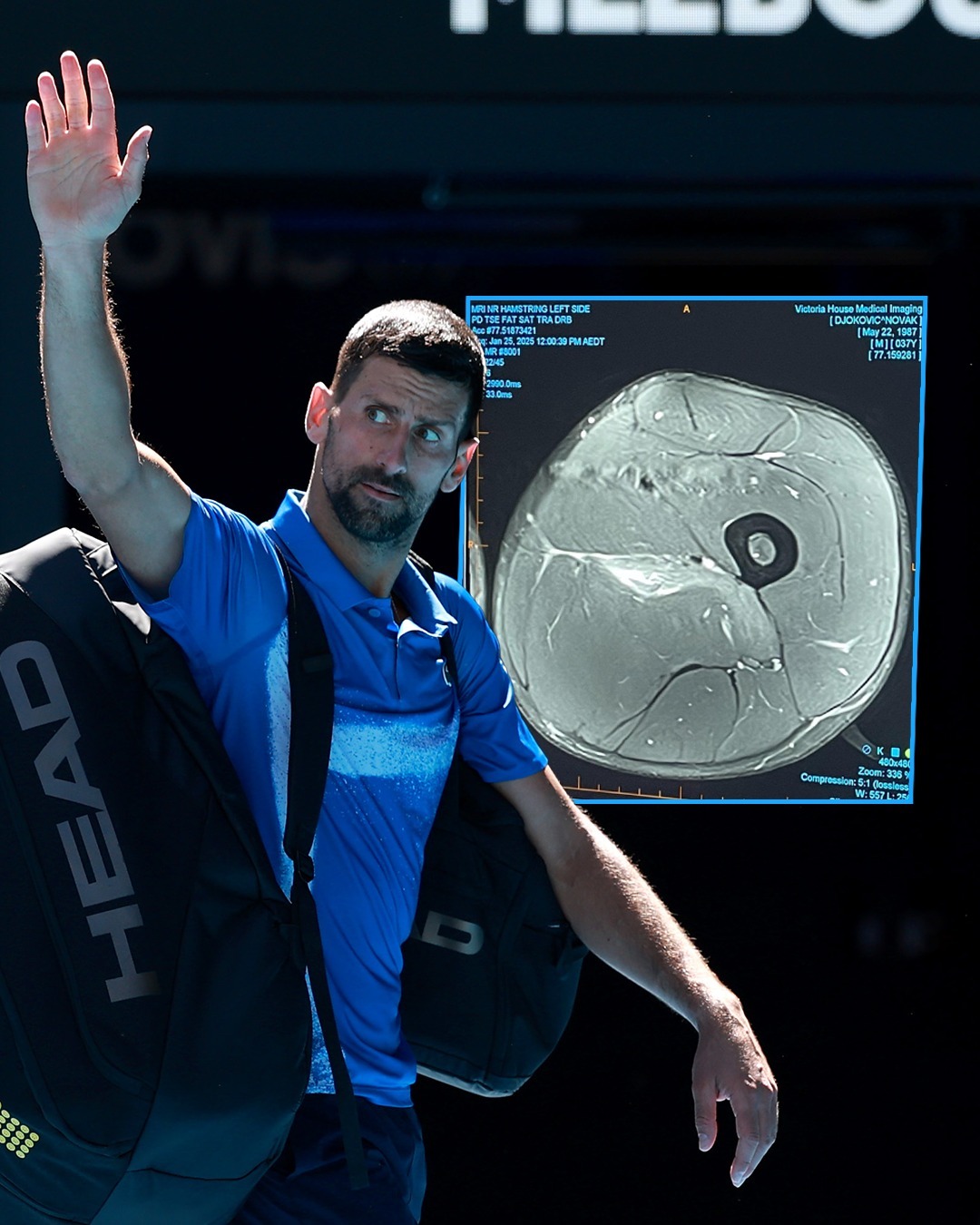 德国网球队血洗欧洲网球队，德约科维奇统治全场